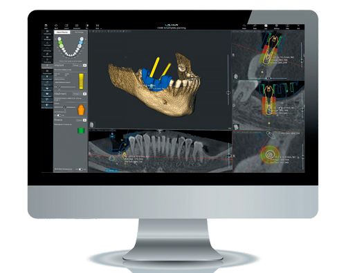 Система рентгеновская с функцией ортопантомографии и конусно-лучевой компьютерной томографии X-MIND RIME ЗD